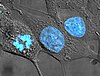 HeLa cells with their nuclei stained blue