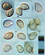 Fig. 2 Spores.