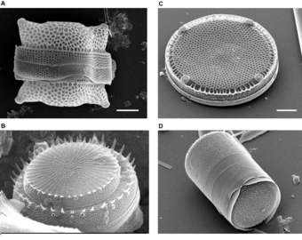 diatoms