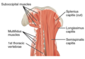 The multifidus muscles (labeled left) as seen in a posterior view of the neck.
