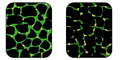 Muscular dystrophy is a genetic disorder where the muscle tissue wastes away and loses function. In the affected muscle (left), the tissue has become disorganized and the concentration of dystrophin (green), an important protein in normal muscle functioning, is greatly reduced.