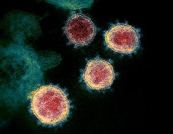 False-coloured transmission electron micrograph of SARS-CoV-2 virions