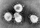 HCoV-229E病毒