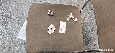 Blood stains from the victimized students found on a chair in the library after the police attack on the evening of 15 December 2019