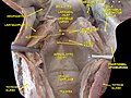 Deep dissection of larynx, pharynx and tongue seen from behind