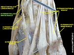 Extensor pollicis brevis muscle