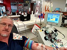 Platelet donation by a single line automatic separation and leukocyte reduction apheresis machine at an Australian donation centre