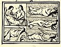 Image 2Depiction of smallpox in Franciscan Bernardino de Sahagún's history of the conquest of Mexico, Book XII of the Florentine Codex, from the defeated Aztecs' point of view (from History of medicine)