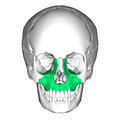 头颅。上颌骨的位置(显示为绿色)。
