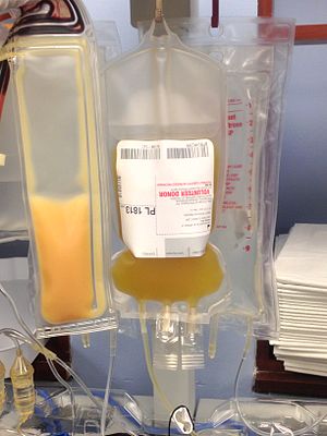 Plasma can be collected simultaneously with a platelet donation.