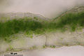 Conocephalum salebrosum, thallus cross section showing photosynthetic cells