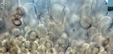 Fig. 4 Cheilocystidia