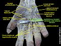 Superficial palmar arterial and venous arches