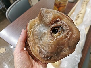 #609 (6/1/2015) Collapsed right eyeball from the same specimen, preserved through plastination and held at Tottori Prefectural Museum but not displayed publicly