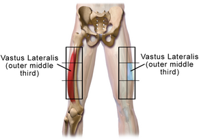 Vastus lateralis site in adult