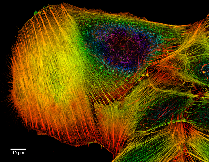 Actin filaments in a cultured bone cancer cell, colour-coded for depth.