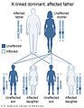 X-linked dominant inheritance, affected father