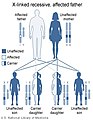 X-linked recessive inheritance, affected father