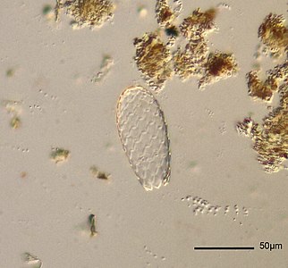 Euglypha tuberculata, a species with a siliceous autogenic test