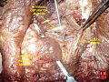 Obturator internus muscle
