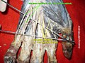 Palmar branch of ulnar nerve
