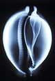 埃及寶螺殼的X射線圖像