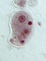 Entamoeba histolytica trophozoite (Conosa: Archamoebae)