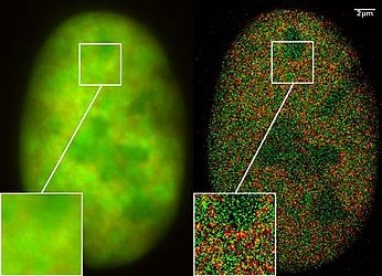 Super-resolution microscopy: Co-localization microscopy (2CLM) with GFP and RFP fusion proteins (nucleus of a bone cancer cell) 120.000 localized molecules in a wide-field area (470 μm2) measured with a Vertico-SMI/SPDMphymod microscope