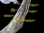 Muscles of leg (lateral view, deep dissection)