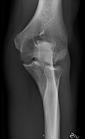 Normal elbow, internal oblique projection