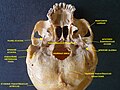 Zygomatic arch, base of skull