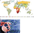 An image showing the prevalnce of HIV/AIDS in the world as well as a cell infected by HIV.