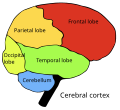 Four cerebral lobes and cerebellum:   Occipital lobe   Parietal lobe   Frontal lobe   Temporal lobe