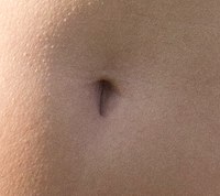 A "T"-shaped navel
