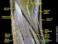 Vastus intermedius muscle