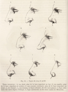 Image showing drawings of various nasal shapes.