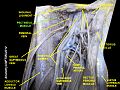 Pectineus muscle