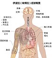 2015年3月8日 (日) 16:46版本的缩略图