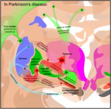 Basal ganglia in Parkinson's disease.png. Vector (.svg) version is available