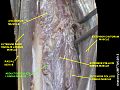 Abductor pollicis longus muscle