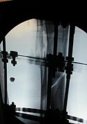 X-ray of the open fracture site immediately after installation of the Ilizarov apparatus.