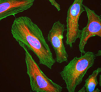 HeLa cells showing actin (stained green), vimentin (red) and DNA (blue)