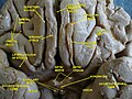 Cerebrum. Inferior view. Deep dissection.