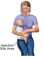 Vastus lateralis site in child