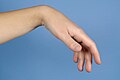 Wrist related tenodesis effect