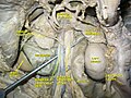 Abdominal cavity.Superior mesenteric vein.Deep dissection.