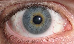 Eye Central Heterochromia crop and lighter