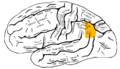 左側大腦半球外側（角回位於橙色標記處）