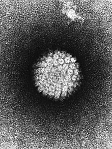 电子显微镜下的人类乳突病毒
