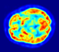 A heatmap in the shape of a brain; the center is less bright.